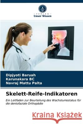 Skelett-Reife-Indikatoren Dipjyoti Baruah Karunakara Bc Navraj Matt 9786203677492 Verlag Unser Wissen - książka