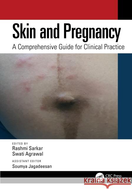 Skin and Pregnancy  9781032583471 Taylor & Francis Ltd - książka
