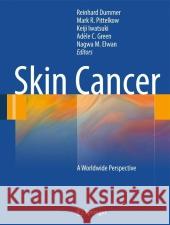 Skin Cancer - A World-Wide Perspective Reinhard Dummer Mark R. Pittelkow Kejii Iwatsuki 9783642050718 Not Avail - książka