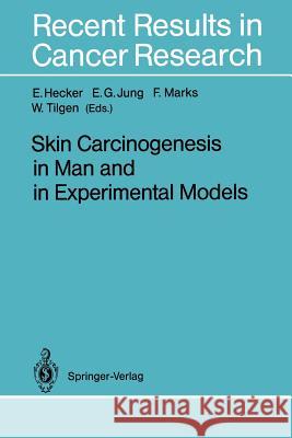 Skin Carcinogenesis in Man and in Experimental Models Erich Hecker E. G. Jung F. Marks 9783642848834 Springer - książka