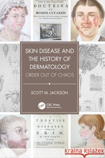 Skin Disease and the History of Dermatology: Order Out of Chaos Scott Jackson 9781032226606 CRC Press - książka