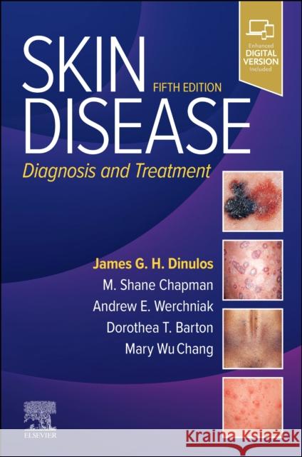 Skin Disease: Diagnosis and Treatment  9780443125393 Elsevier Health Sciences - książka
