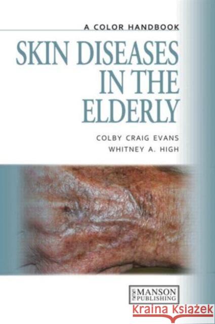 Skin Diseases in the Elderly : A Color Handbook Colby Craig Evans 9781840761542  - książka