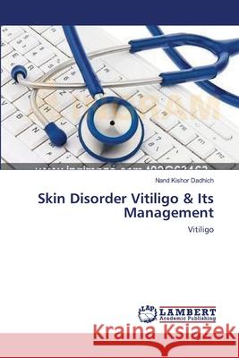 Skin Disorder Vitiligo & Its Management Dadhich Nand Kishor 9783659475368 LAP Lambert Academic Publishing - książka