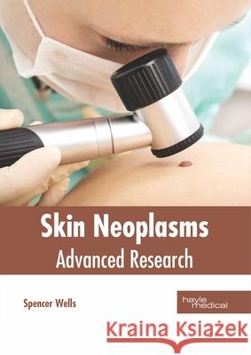 Skin Neoplasms: Advanced Research Spencer Wells 9781632415783 Hayle Medical - książka