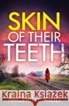 Skin of Their Teeth Michelle Kidd 9781805733096 Joffe Books