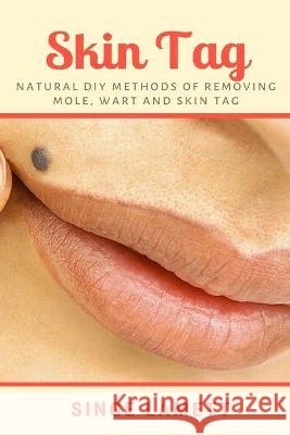 Skin Tag: Natural DIY Methods of removing Mole, Wart and Skin Tag Singe Lamett 9781637502570 Aos Media - książka