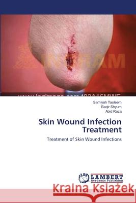 Skin Wound Infection Treatment Tasleem, Samiyah 9783659616686 LAP Lambert Academic Publishing - książka