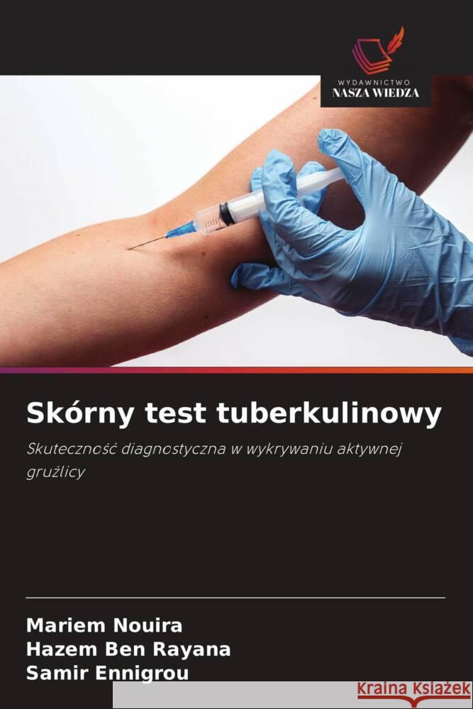 Sk?rny test tuberkulinowy Mariem Nouira Hazem Be Samir Ennigrou 9786208329693 Wydawnictwo Nasza Wiedza - książka