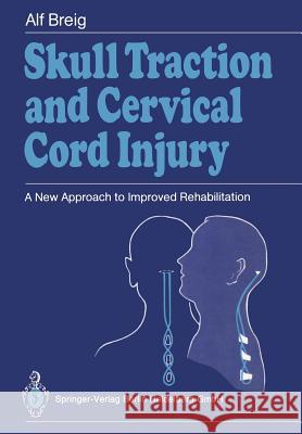 Skull Traction and Cervical Cord Injury: A New Approach to Improved Rehabilitation Silver, John R. 9783540504146 Springer - książka