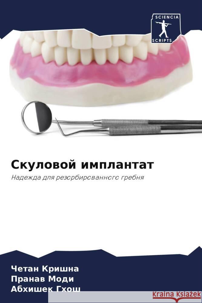 Skulowoj implantat Krishna, Chetan, Modi, Pranaw, Ghosh, Abhishek 9786206345718 Sciencia Scripts - książka