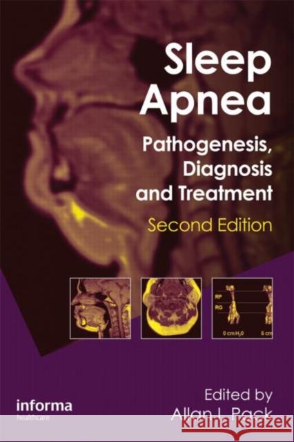 Sleep Apnea: Pathogenesis, Diagnosis and Treatment Pack, Allan I. 9780849396977 Informa Healthcare - książka