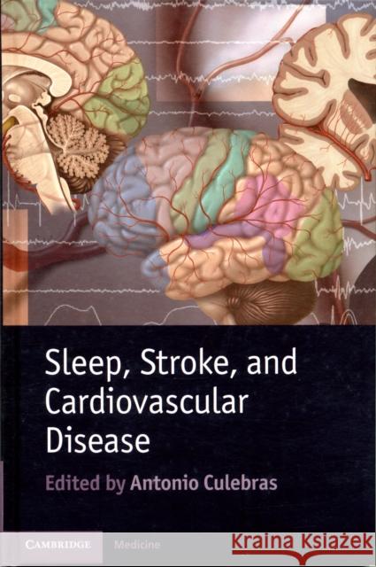 Sleep, Stroke and Cardiovascular Disease Antonio Culebras 9781107016415  - książka