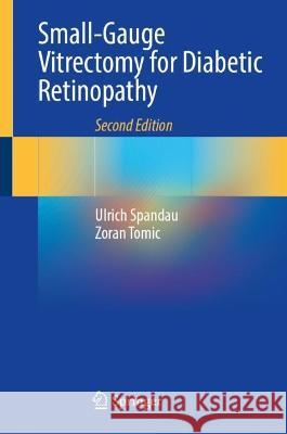 Small-Gauge Vitrectomy for Diabetic Retinopathy Ulrich Spandau Zoran Tomic 9783031262036 Springer - książka