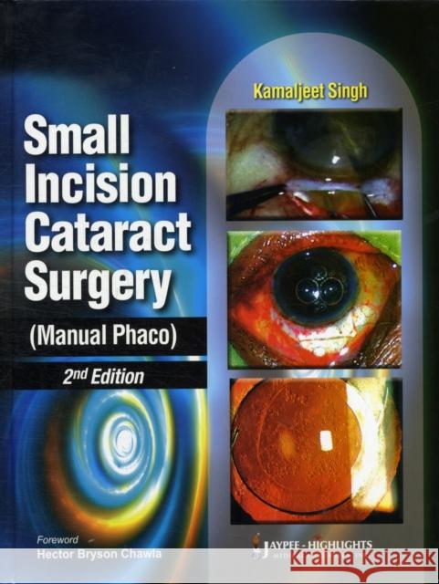 Small Incision Cataract Surgery (Manual Phaco) Kamaljeet Singh 9788184489804  - książka