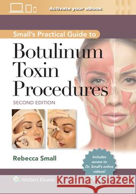 Small's Practical Guide to Botulinum Toxin Procedures Rebecca Small 9781975192853 Wolters Kluwer Health - książka