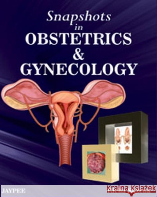 Snapshots in Obstetrics and Gynaecology Richa Saxena 9789350258026 Jaypee Brothers Medical Publishers - książka