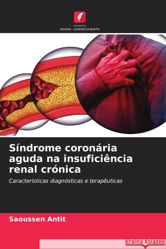 Síndrome coronária aguda na insuficiência renal crónica Antit, Saoussen 9786204485584 Edições Nosso Conhecimento - książka