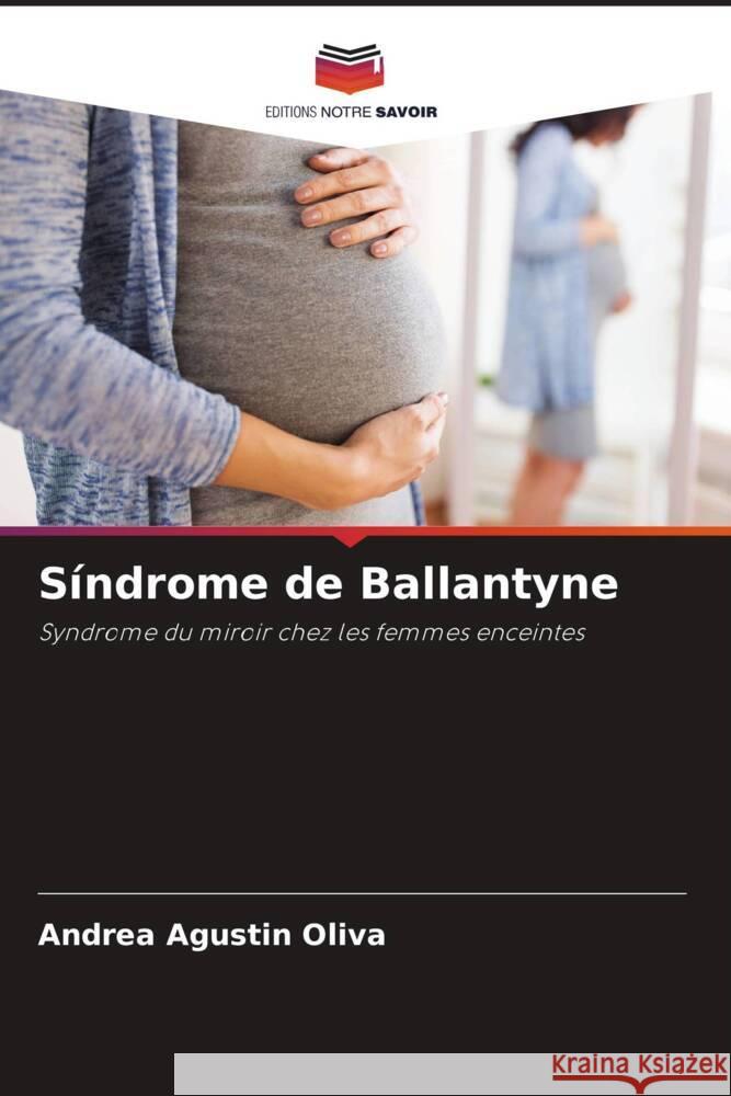 S?ndrome de Ballantyne Andrea Agust? 9786206854098 Editions Notre Savoir - książka