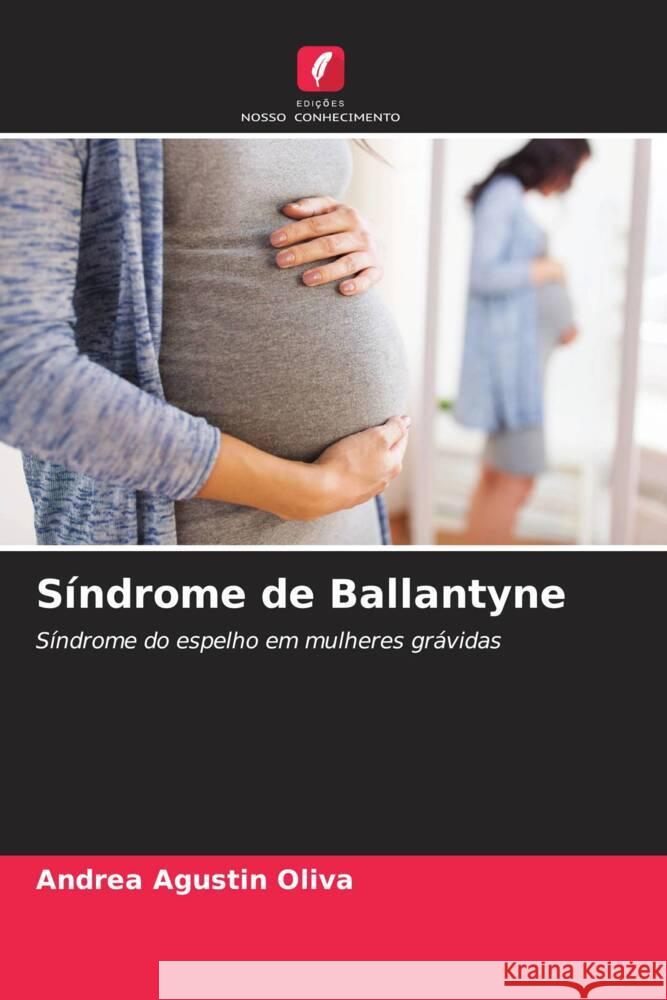 S?ndrome de Ballantyne Andrea Agust? 9786206854111 Edicoes Nosso Conhecimento - książka