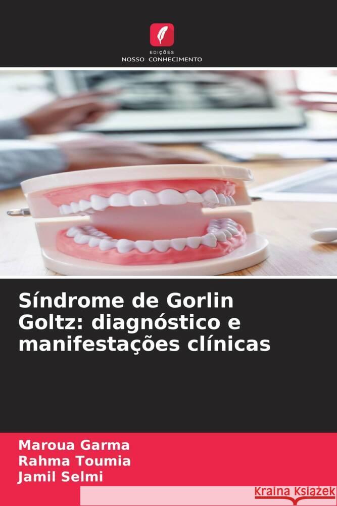 Síndrome de Gorlin Goltz: diagnóstico e manifestações clínicas Garma, Maroua, Toumia, Rahma, Selmi, Jamil 9786208254261 Edições Nosso Conhecimento - książka