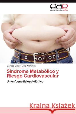 Síndrome Metabólico y Riesgo Cardiovascular Lima Martínez Marcos Miguel 9783845488691 Editorial Acad Mica Espa Ola - książka