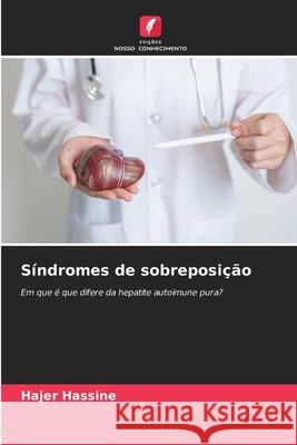 Síndromes de sobreposição Hassine, Hajer 9786209113000 Edições Nosso Conhecimento - książka