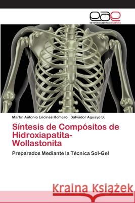 Síntesis de Compósitos de Hidroxiapatita-Wollastonita Martín Antonio Encinas Romero, Salvador Aguayo S 9783659080449 Editorial Academica Espanola - książka