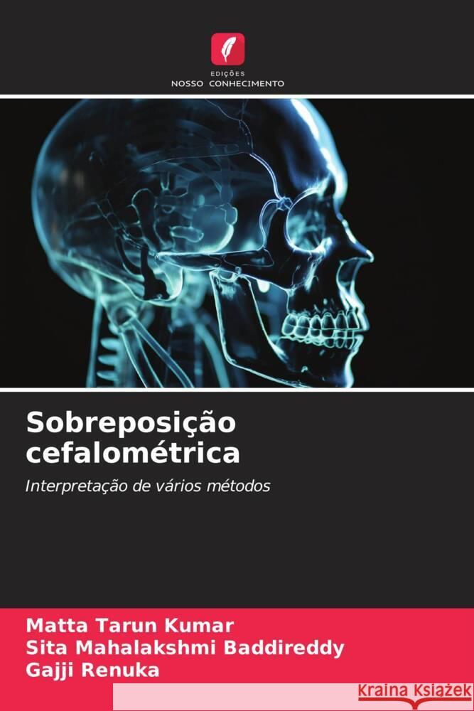 Sobreposi??o cefalom?trica Matta Taru Sita Mahalakshmi Baddireddy Gajji Renuka 9786206633976 Edicoes Nosso Conhecimento - książka