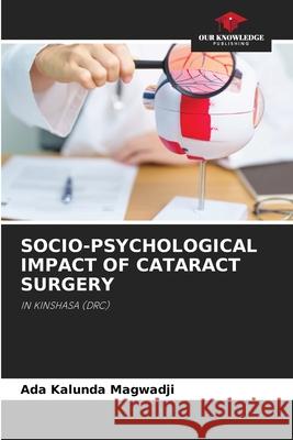 SOCIO-PSYCHOLOGICAL IMPACT OF CATARACT SURGERY Kalunda Magwadji, Ada 9786208947057 Our Knowledge Publishing - książka