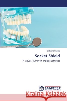Socket Shield Chavre, Dr.Kranti 9786209412714 LAP Lambert Academic Publishing - książka
