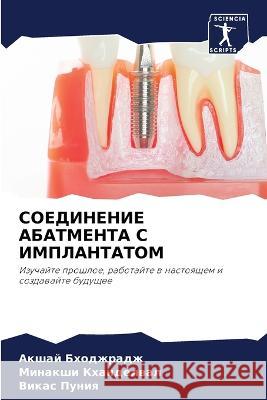 SOEDINENIE ABATMENTA S IMPLANTATOM Bhodzhradzh, Akshaj, KHANDELVAL, Minakshi, Puniq, Vikas 9786205994078 Sciencia Scripts - książka