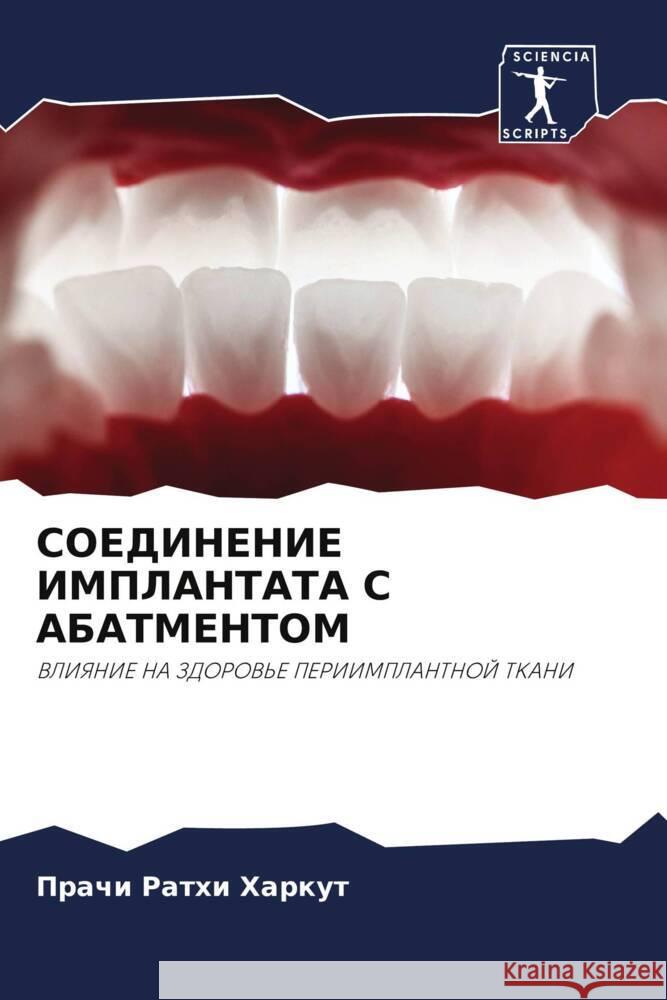 SOEDINENIE IMPLANTATA S ABATMENTOM Rathi Harkut, Prachi 9786208174323 _ CRC Press - książka