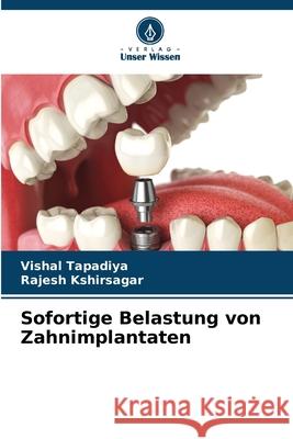 Sofortige Belastung von Zahnimplantaten Vishal Tapadiya Rajesh Kshirsagar 9786207660759 Verlag Unser Wissen - książka