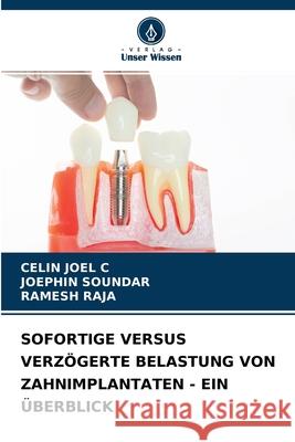 Sofortige Versus Verzögerte Belastung Von Zahnimplantaten - Ein Überblick Celin Joel C, Joephin Soundar, Ramesh Raja 9786204149981 Verlag Unser Wissen - książka