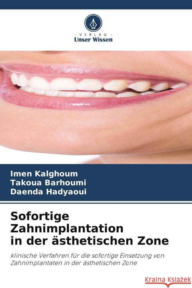 Sofortige Zahnimplantation in der ästhetischen Zone Kalghoum, Imen, Barhoumi, Takoua, Hadyaoui, Daenda 9786206435044 Verlag Unser Wissen - książka