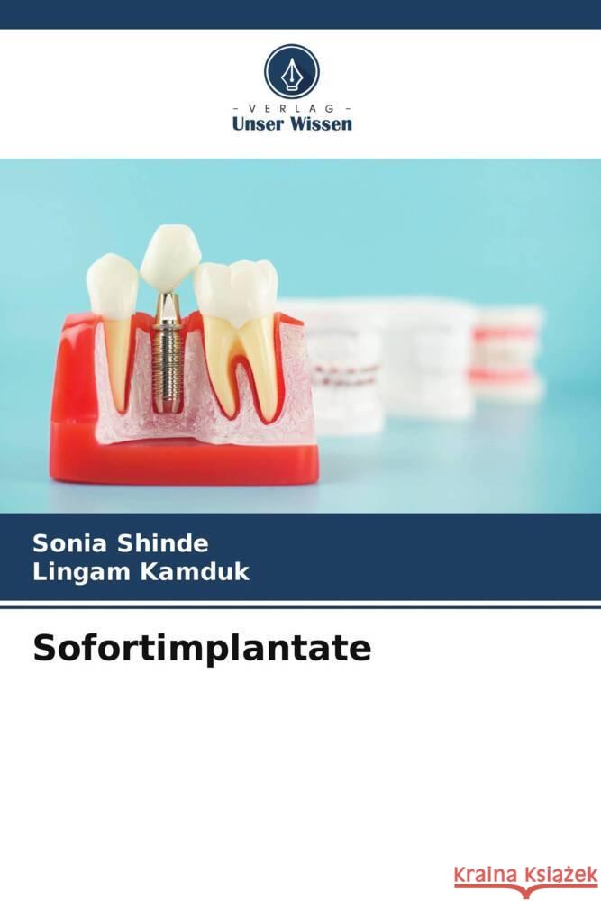 Sofortimplantate SHINDE, SONIA, KAMDUK, LINGAM 9786208631468 Verlag Unser Wissen - książka