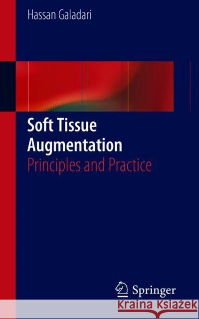 Soft Tissue Augmentation: Principles and Practice [With CD/DVD] Galadari, Hassan 9783662558423 Springer - książka