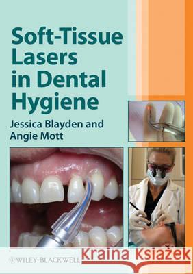 Soft-Tissue Lasers in Dental H Blayden, Jessica 9780470958544  - książka