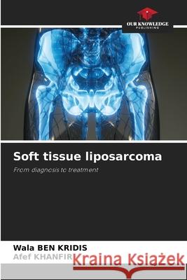 Soft tissue liposarcoma Wala Be Afef Khanfir 9786209596568 Our Knowledge Publishing - książka