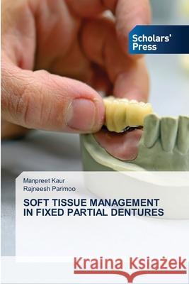Soft Tissue Management in Fixed Partial Dentures Manpreet Kaur, Rajneesh Parimoo 9786138951711 Scholars' Press - książka