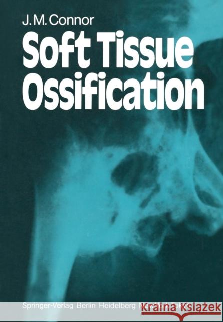 Soft Tissue Ossification J. M. Connor V. A. McKusick 9781447113454 Springer - książka