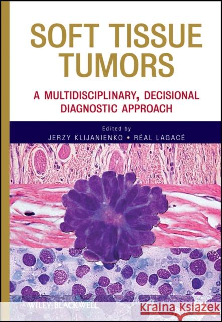 Soft Tissue Tumors: A Multidisciplinary, Decisional Diagnostic Approach Klijanienko, Jerzy 9780470505717  - książka