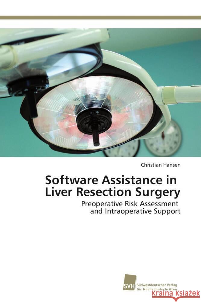 Software Assistance in Liver Resection Surgery : Preoperative Risk Assessment and Intraoperative Support Hansen, Christian 9783838130781 Südwestdeutscher Verlag für Hochschulschrifte - książka