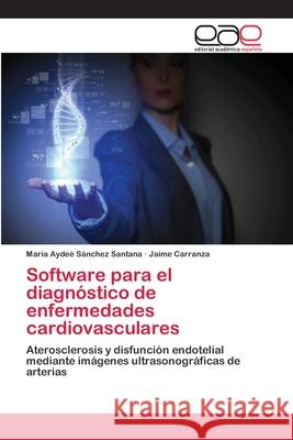 Software para el diagnóstico de enfermedades cardiovasculares Sánchez Santana, María Aydeé 9783659014741 Editorial Academica Espanola - książka