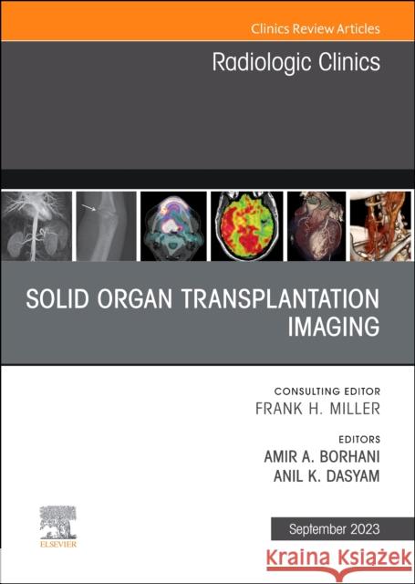 Solid organ transplantation imaging, An Issue of Radiologic Clinics of North America  9780443181771 Elsevier Health Sciences - książka