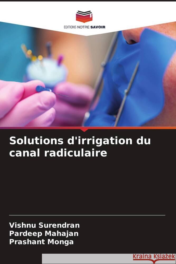 Solutions d'irrigation du canal radiculaire Surendran, Vishnu, Mahajan, Pardeep, Monga, Prashant 9786206302230 Editions Notre Savoir - książka