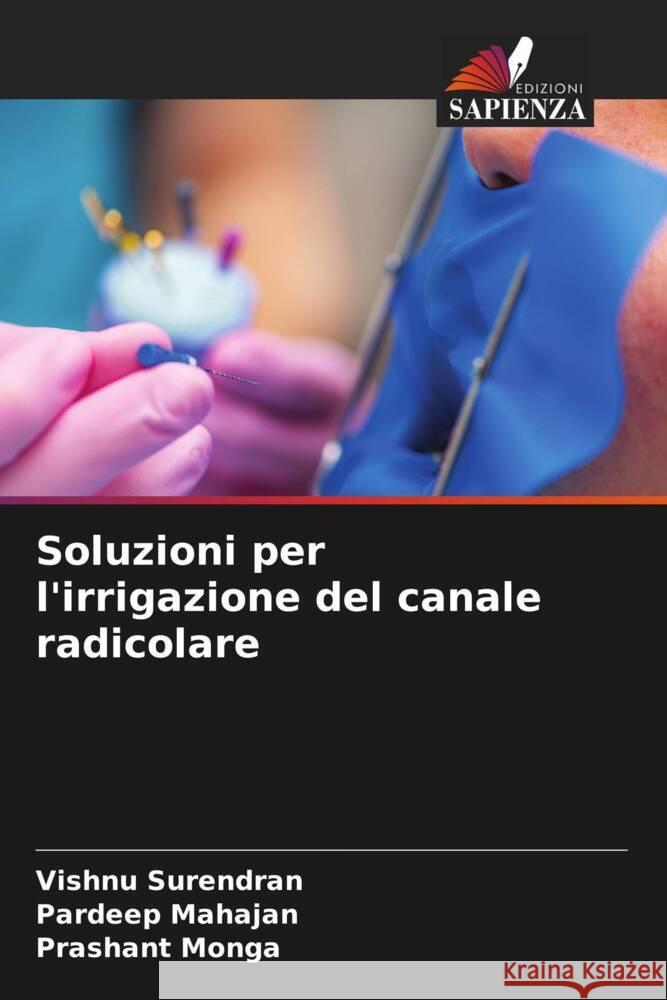 Soluzioni per l'irrigazione del canale radicolare Surendran, Vishnu, Mahajan, Pardeep, Monga, Prashant 9786206302223 Edizioni Sapienza - książka