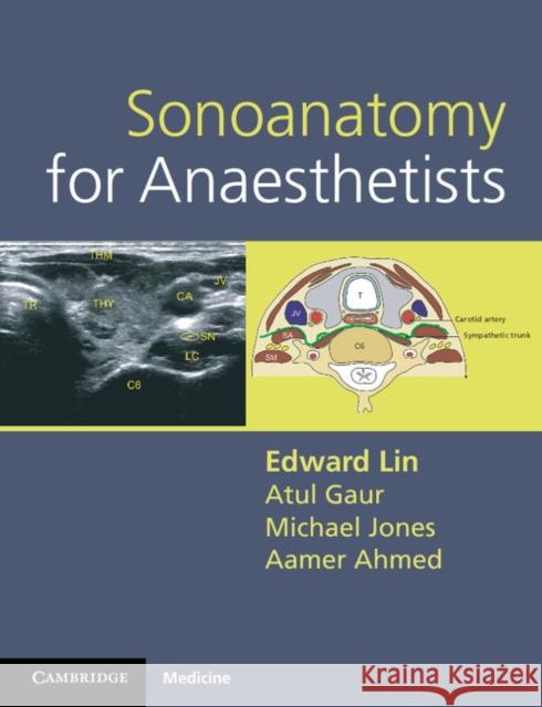 Sonoanatomy for Anaesthetists Edward Lin 9780521106665 CAMBRIDGE UNIVERSITY PRESS - książka