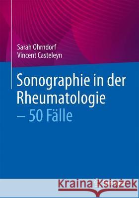 Sonographie in Der Rheumatologie - 50 Fälle Ohrndorf, Sarah 9783662638439 Springer - książka